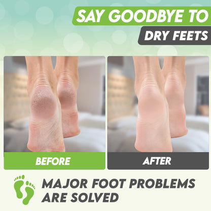 Karma Peach Foot Peel Mask – Helps Remove Callus &amp; Repair Cracked Heels by Karma Organic – For Men &amp; Women [2 Pack]