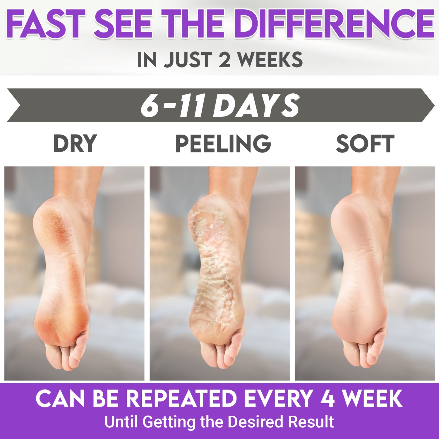 Karma lavender Foot Peel Mask – Helps Remove Callus &amp; Repair Cracked Heels by Karma Organic – For Men &amp; Women [2 Pack]