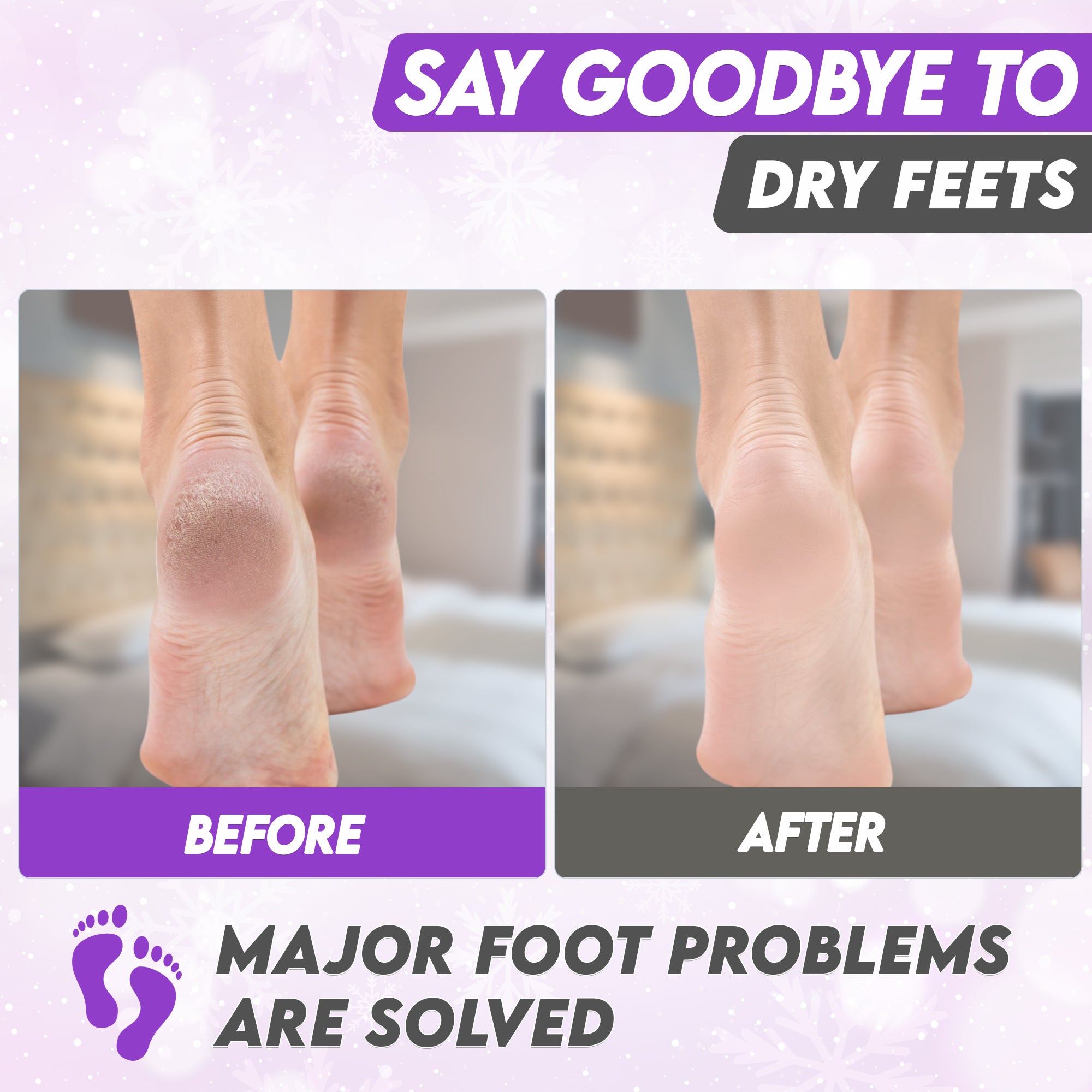 Karma lavender Foot Peel Mask – Helps Remove Callus &amp; Repair Cracked Heels by Karma Organic – For Men &amp; Women [2 Pack]