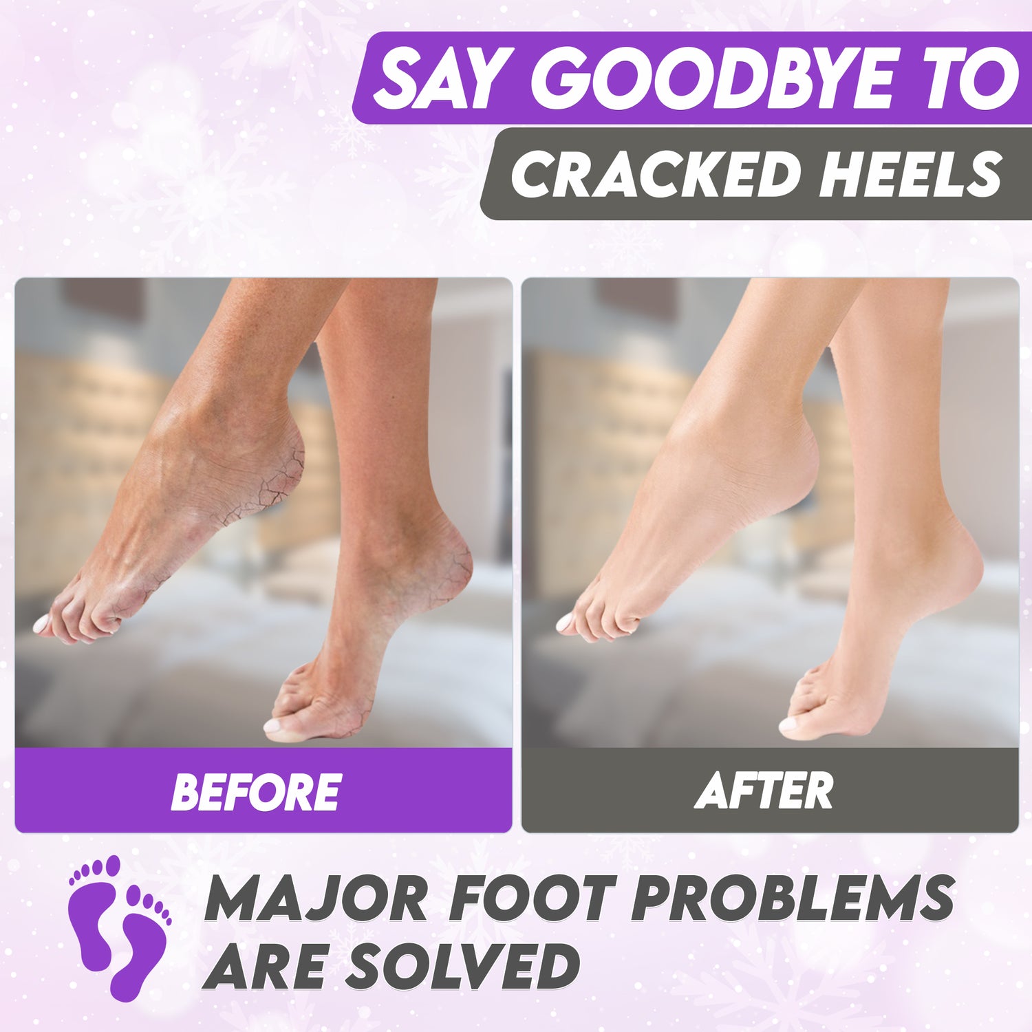 Karma lavender Foot Peel Mask – Helps Remove Callus &amp; Repair Cracked Heels by Karma Organic – For Men &amp; Women [2 Pack]