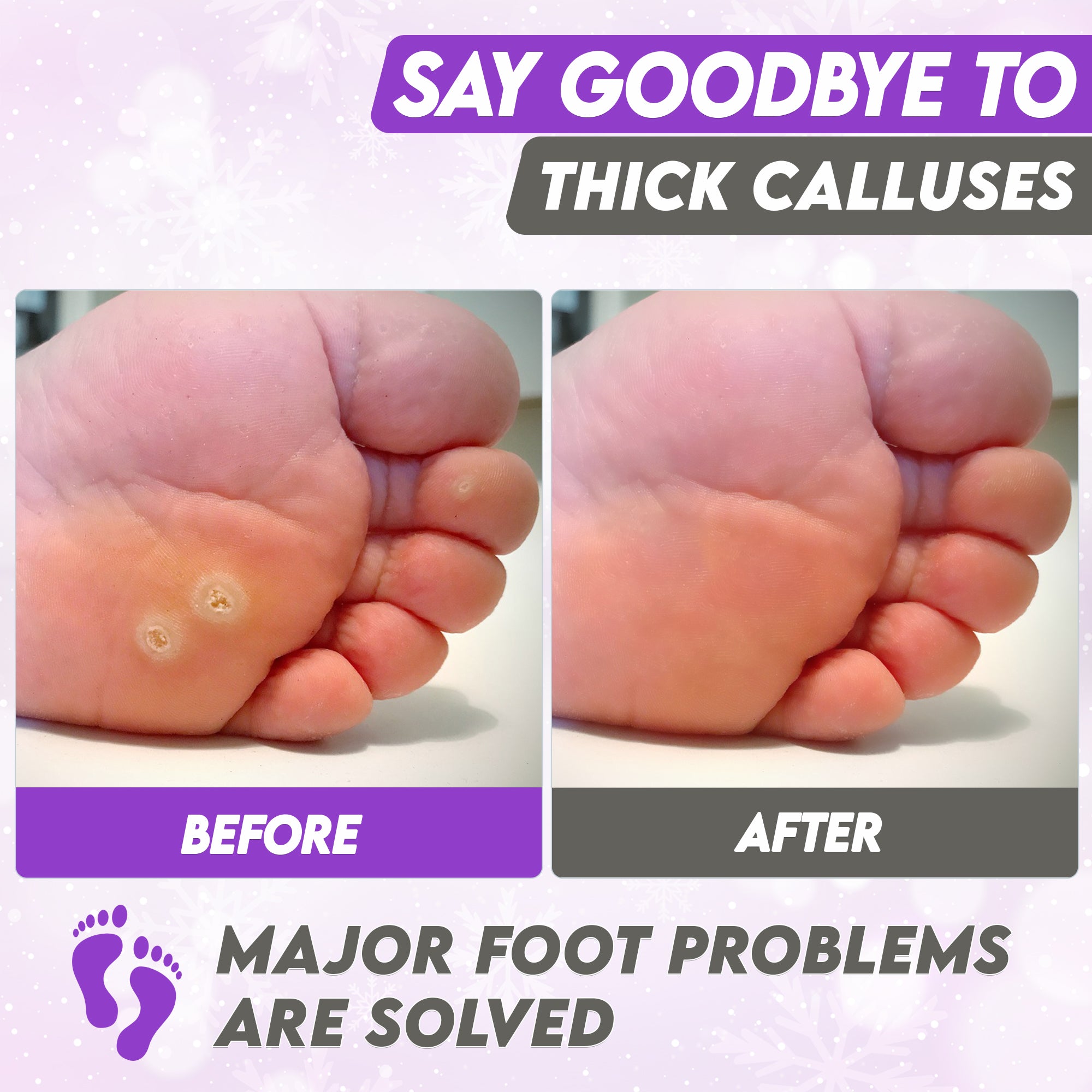 Karma lavender Foot Peel Mask – Helps Remove Callus &amp; Repair Cracked Heels by Karma Organic – For Men &amp; Women [2 Pack]