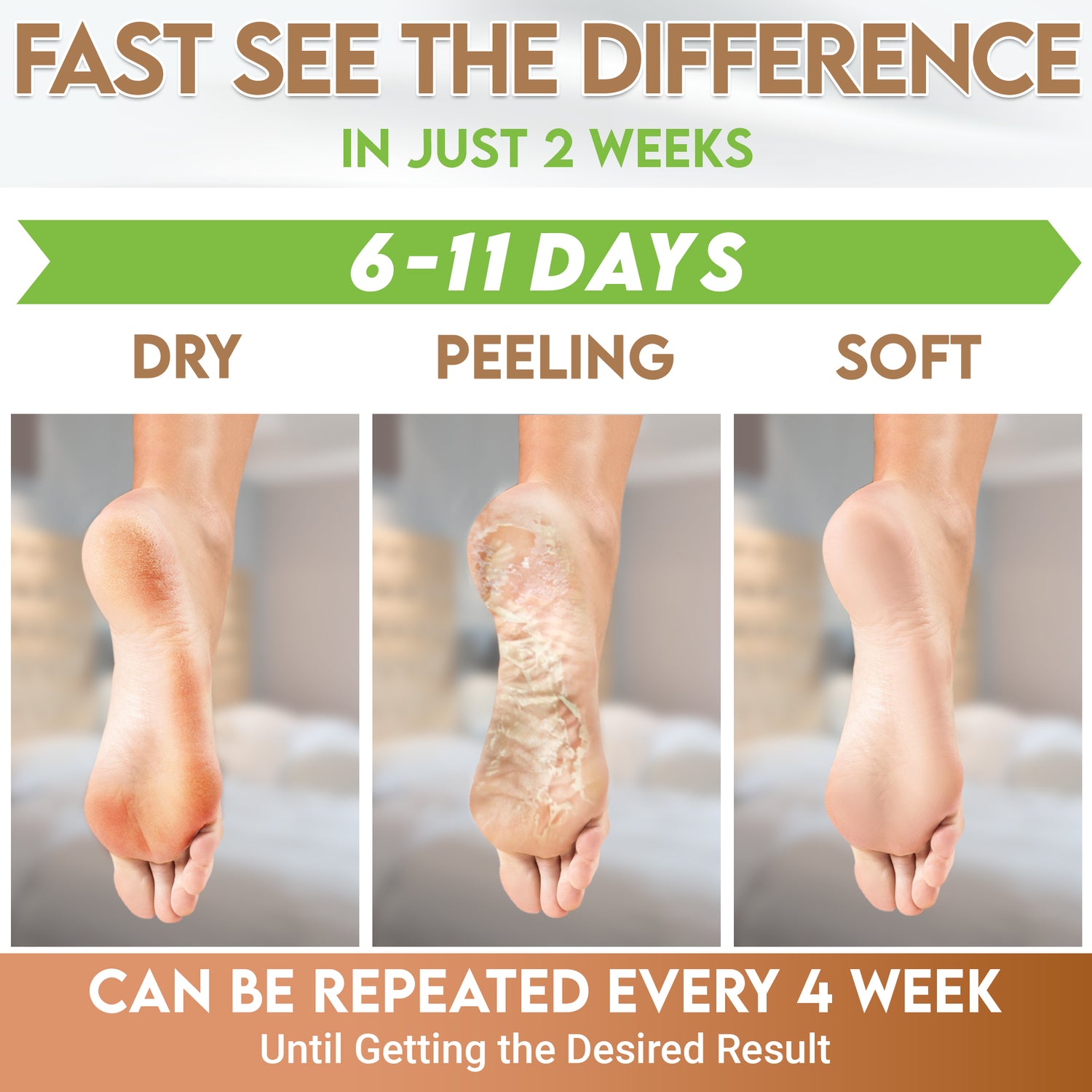 Peeling My Feet So Dry Cracked Get Foot Cream For Cracked Heels Online By Fixderma – Fixderma